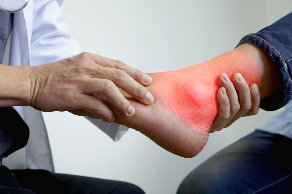 Charcot foot Treatment Boca Raton Florida