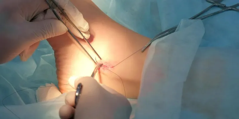 Ankle-Joint-Surgery