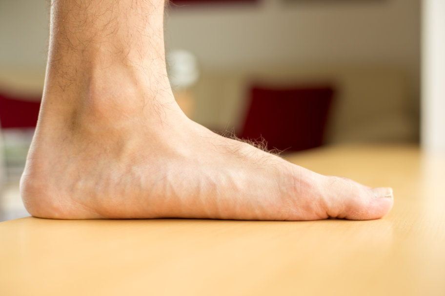 Flat foot Flat foot