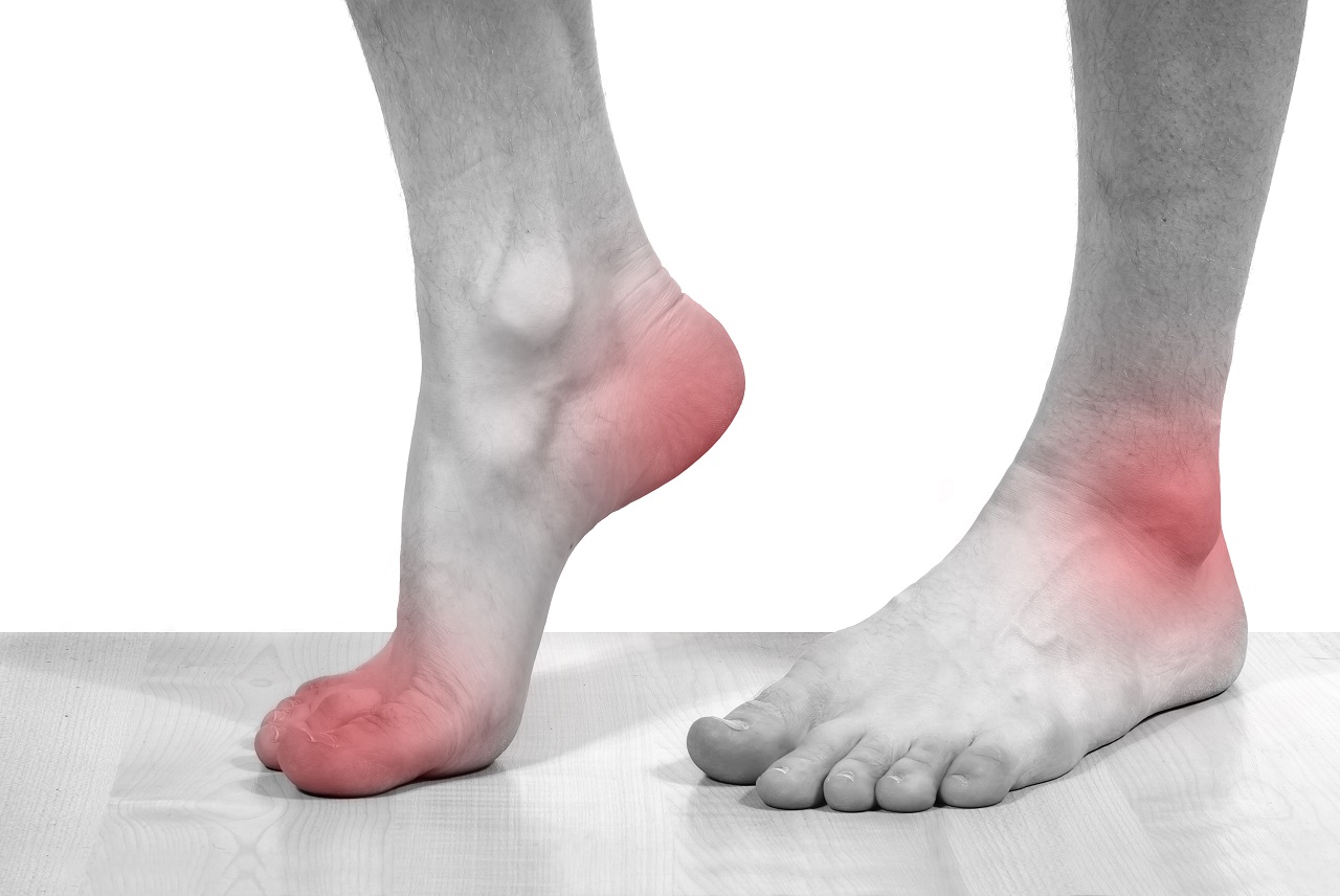 Heel Pain, causes and treatment, plantar fasciitis - YouTube