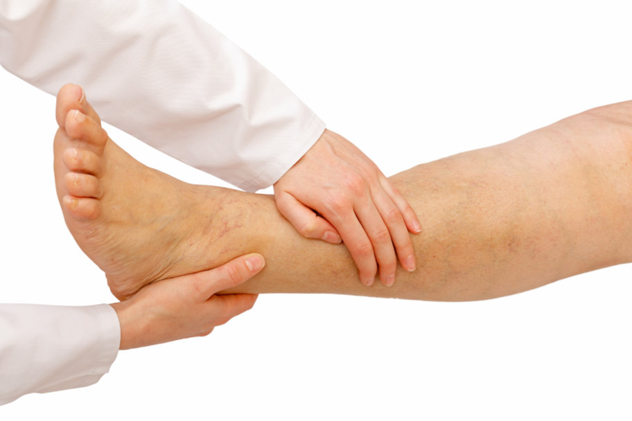 swollen legs swollen legs ankle treatment in boca raton fl