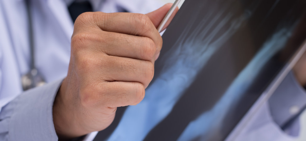 Foot or Ankle Surgery Preparing for your Procedure