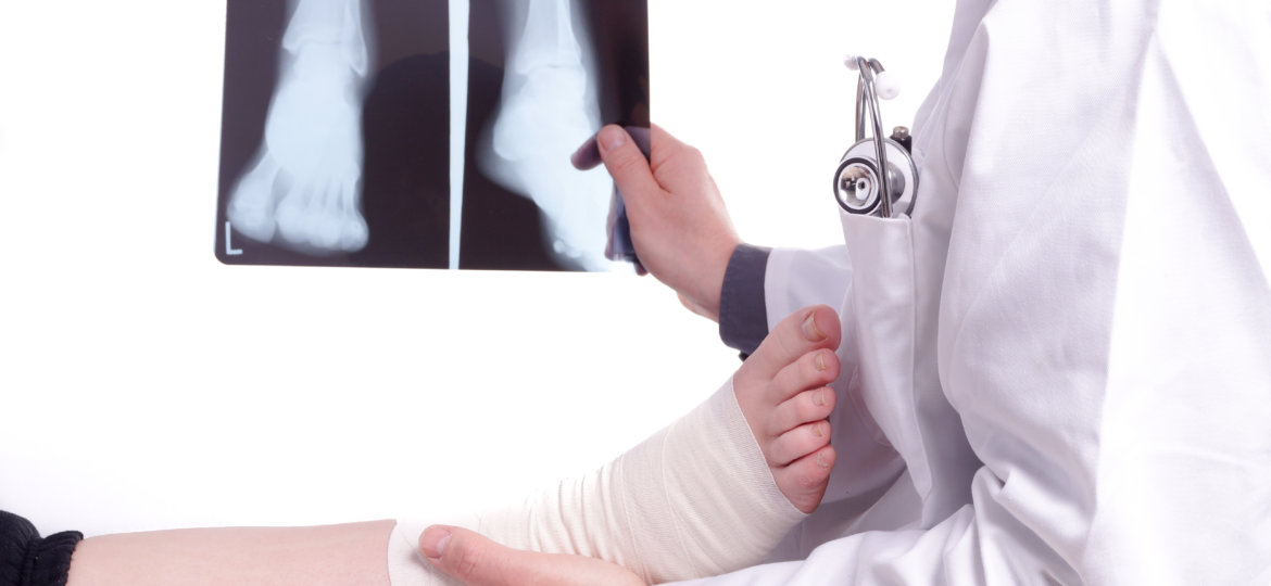 Dr. Kinmon Complete Ankle Replacement Surgery for Patient