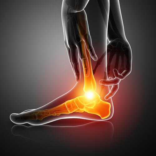 Ankle Joint Replacement Surgery Boca Raton, FL