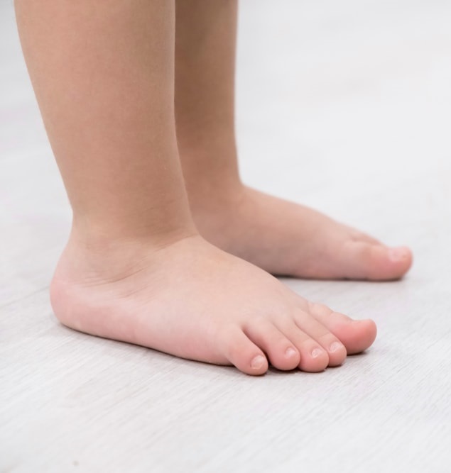 Pediatric Flat Foot Certified Foot and Ankle Specialists