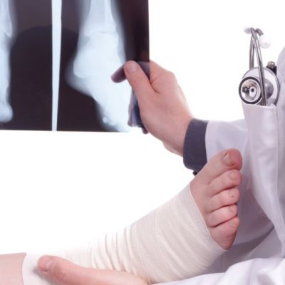 complete ankle replacement surgery foot and ankle specialist boca raton florida