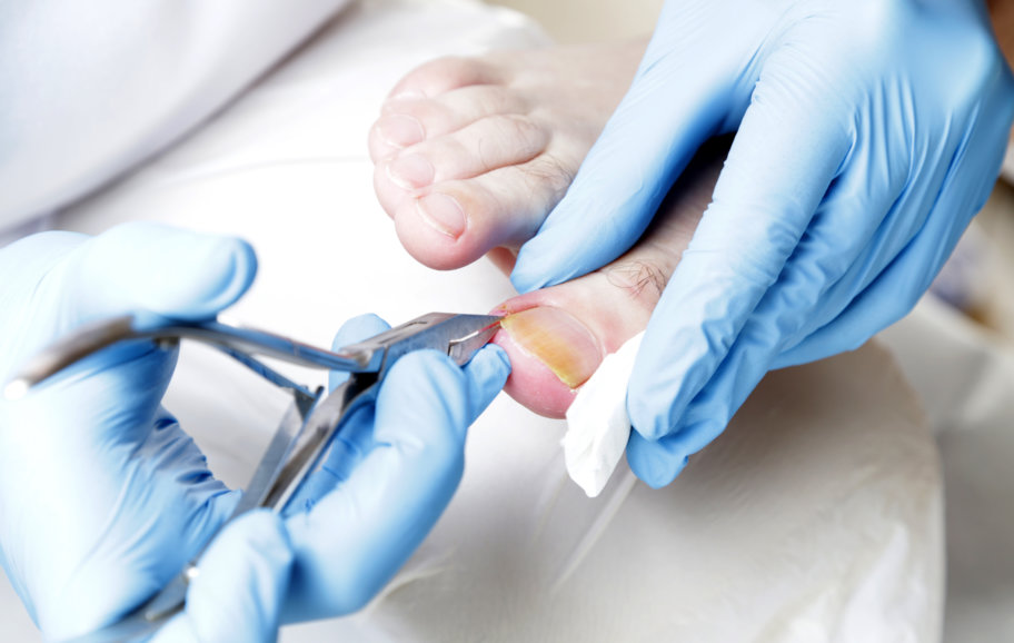 When Does an Ingrown Toenail Require a Visit to the Podiatrist?: Arizona  Foot & Ankle Specialists : Podiatric Medicine and Surgery