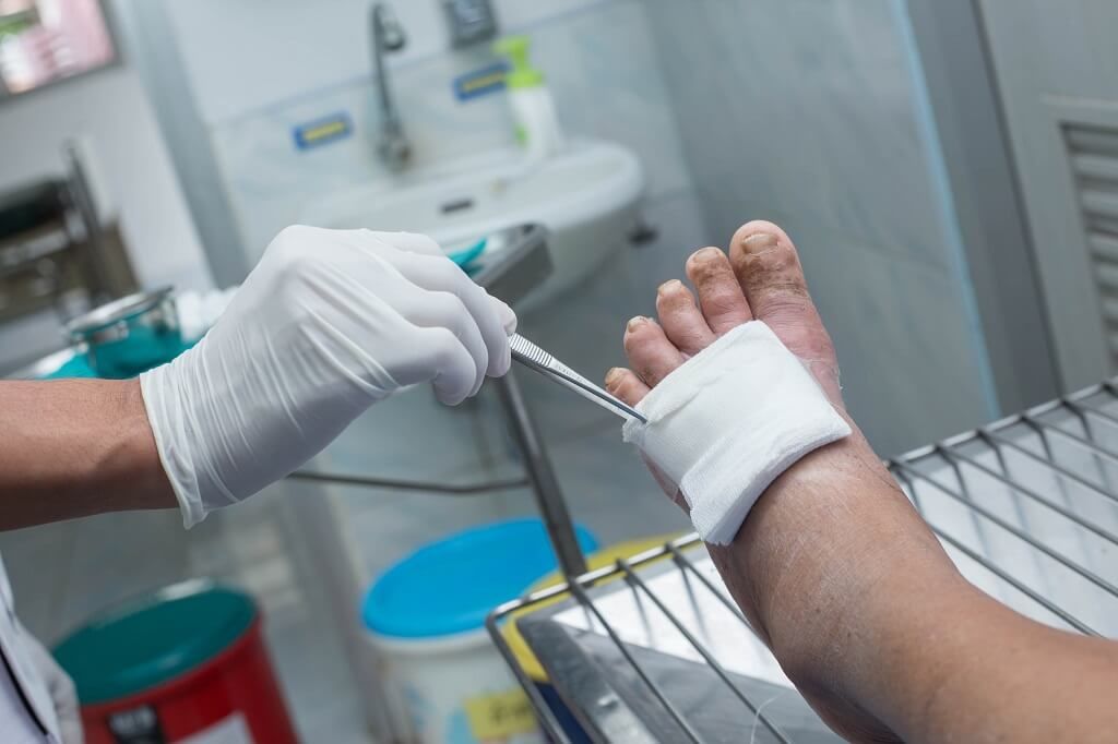 Routine Diabetic Foot Care