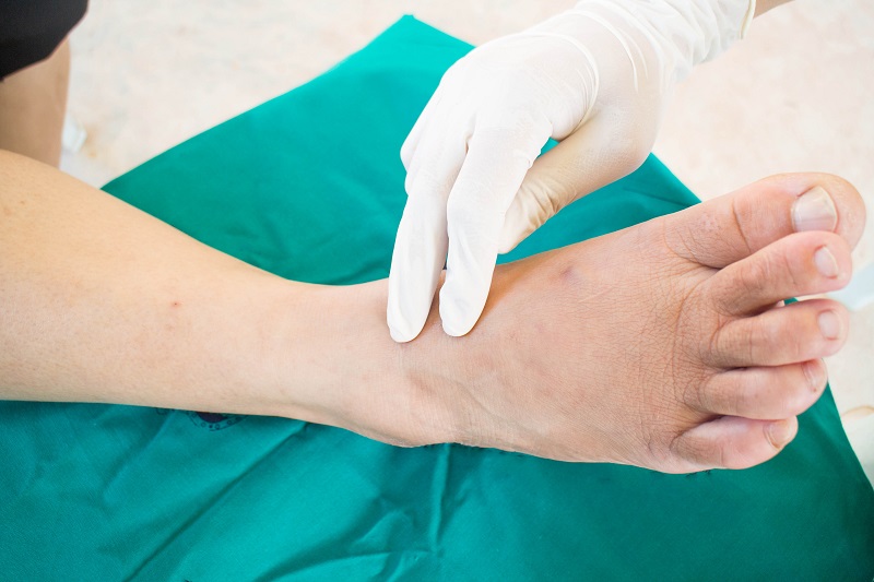 What you should know about Wound and Diabetic Foot Treatment