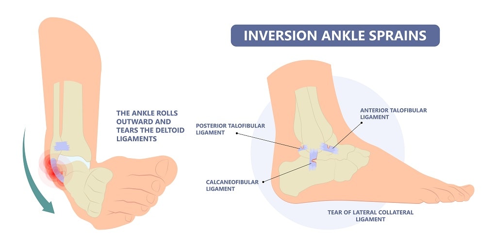 foot inversion range of motion