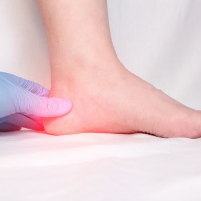 heel-pain-plantar-fasciitis