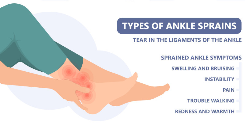 types-of-ankle-sprains