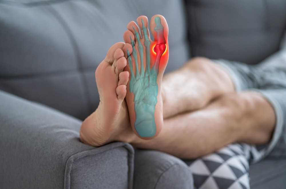 Big Toe Arthritis (Hallux Rigidus) Symptoms & Causes