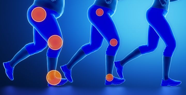 Does Being Overweight Cause Ankle Pain 