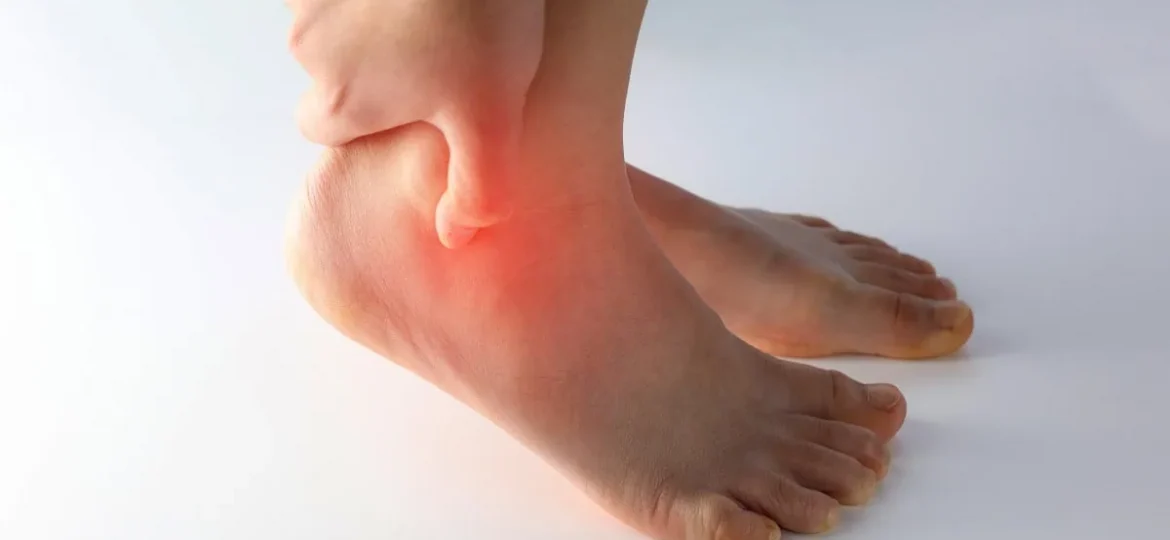Tarsal Sinus Syndrome sinus tarsi