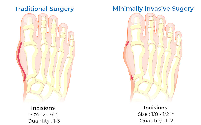 minimally-invasive-surgery-christopher-miller