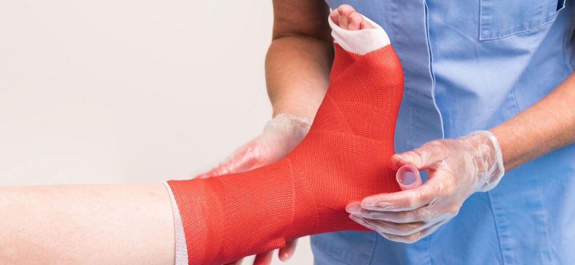 broken ankle fracture