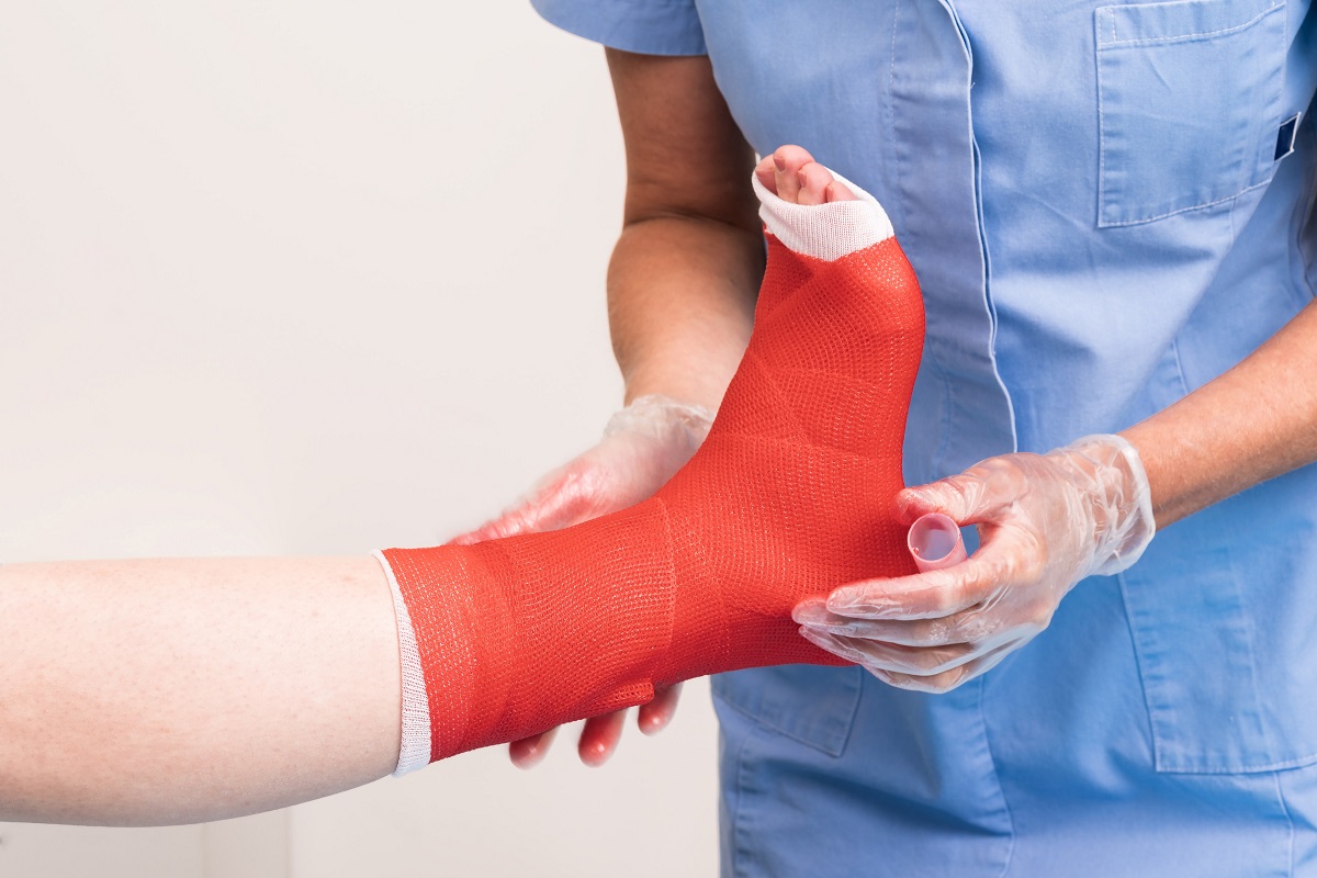 Broken Ankle Fracture: Essential Tips for a Successful Recovery