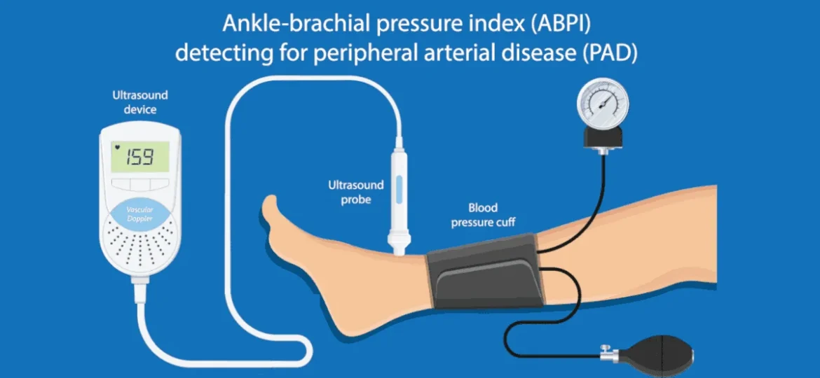 ankle brachial index test