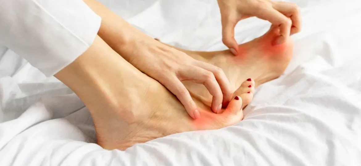 itchy-feet-at-night-causes-remedies-and-expert-care