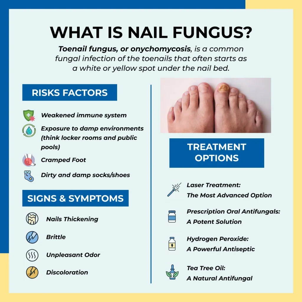 what is toe nail fungus and what kills toenail fungus instantly