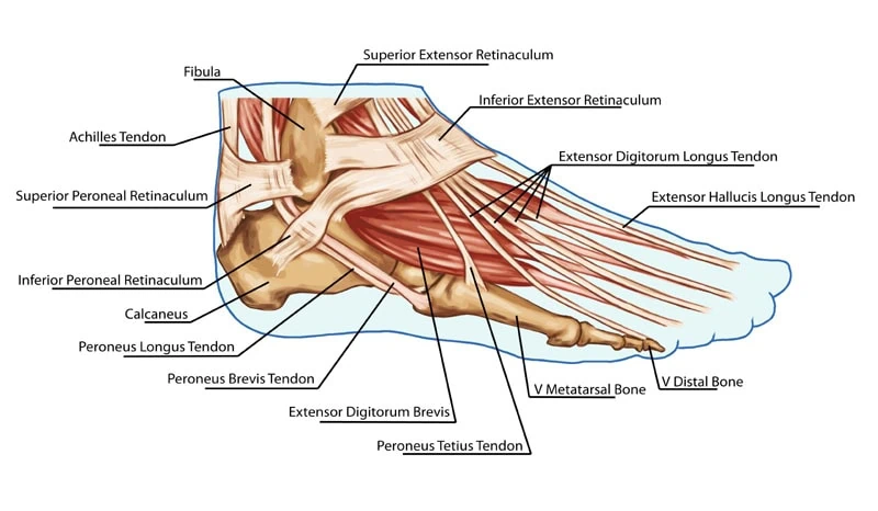 tendons in top of foot extensor tendonitis infographic