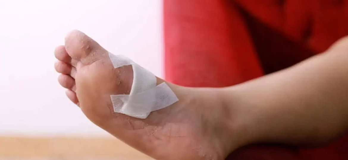 diabetic foot injection