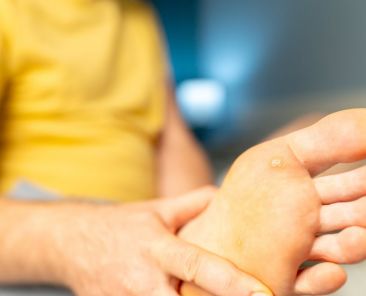 how to remove plantar warts