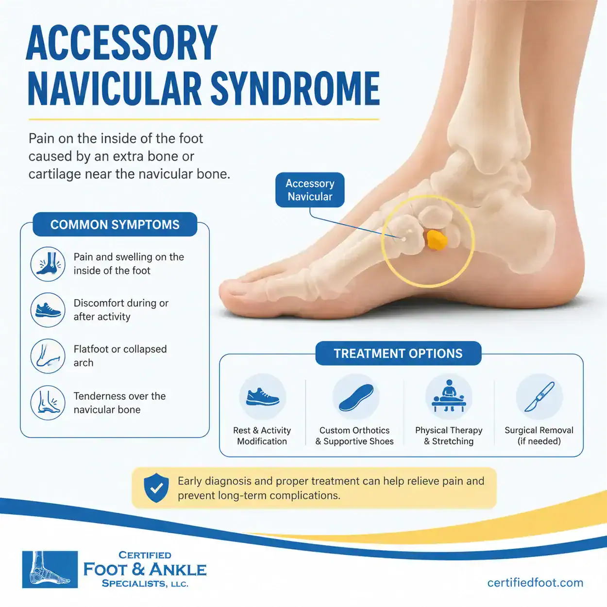 Accessory Navicular Syndrome Infographic Symptoms and Treatment